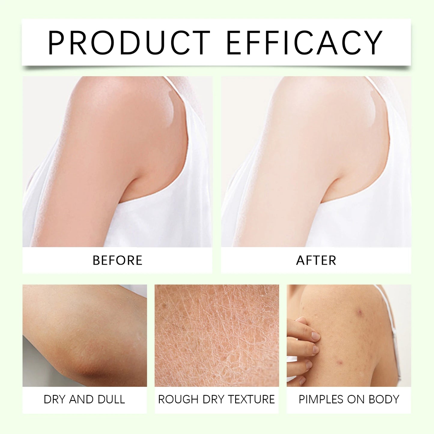 Shea Butter Body Lotion Moisturizing Magnesium Body Butter Nourishing Skin Soft Smooth Soothes Muscles Body Skincare Cream